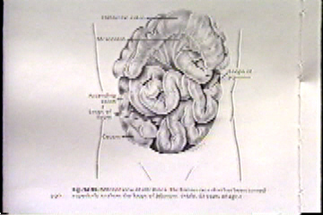 Diagram of the human body, showing the intestines